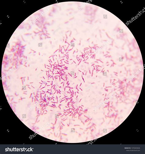 Gram Staining Bacteria Under Microscope Stock Photo 1076943026 ...