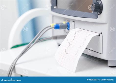 Electronic Fetal Monitor EFM Performing Cardiotocography CTG Monitoring Fetal Heartbeat Close-up ...