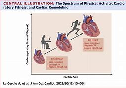 Image result for HFPEF