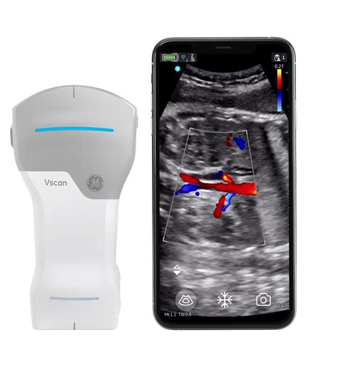 Vscan Air - Tradintek