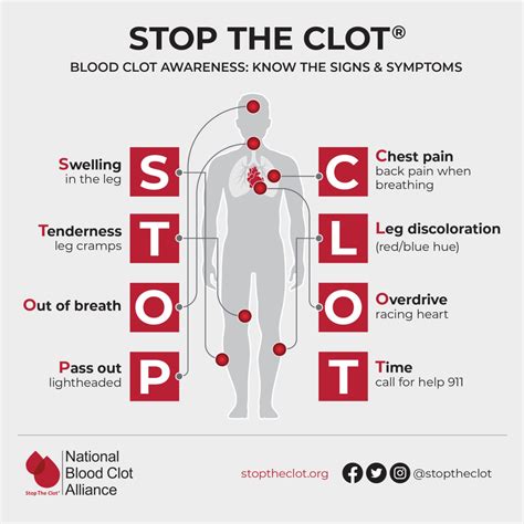 Blood Clot Info: Risks, Symptoms, Treatment & Prevention