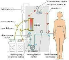 Explain the principle of dialysis with the help of a labeled diagram ...