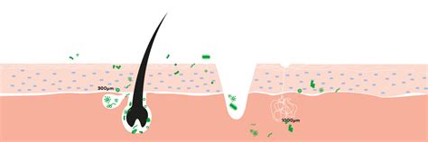 Managing The Risk Factors for Surgical Site Infections | 3M India