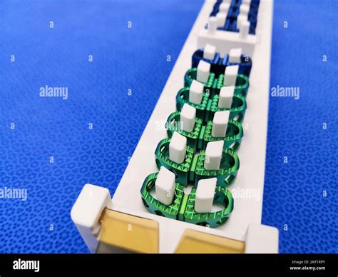 Closeup Image Of Lumbar Spinal Fusion Implant Stock Photo - Alamy