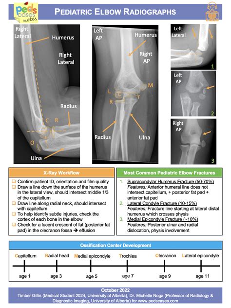 Pediatric Elbow Radiographs | PedsCases
