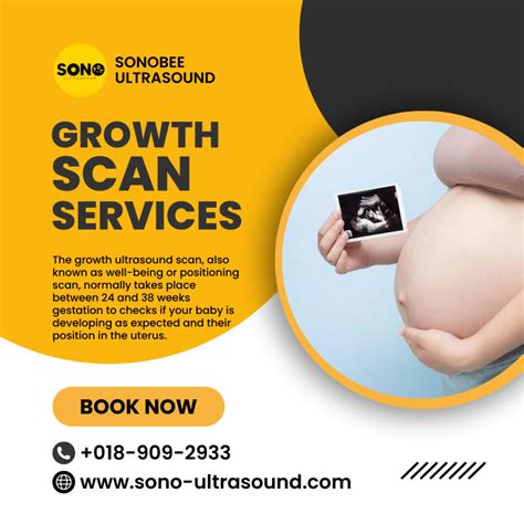 Sonobee Ultrasound Scan Center Kedah | Baby Scans & Pregnancy Imaging