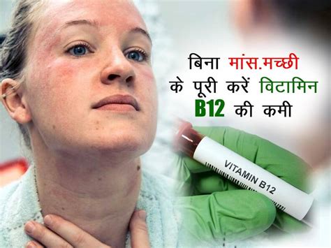 Vegetarian Sources For Vitamin B12 : शरीर में Vitamin B12 की बार-बार ...