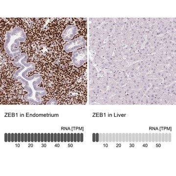 Monoclonal Anti-ZEB1 antibody produced in mouse Prestige Antibodies ...
