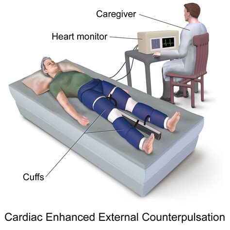 External Counter Pulsation Treatment