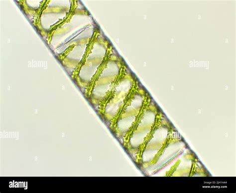 Spirogyra Under Microscope 400x Labeled