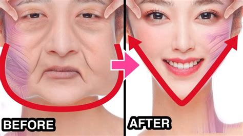 Image result for V-shape Face Exercise