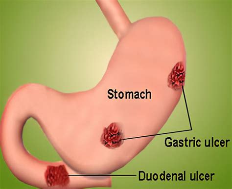 Homeopathic Treatment Kolkata - Homeopathic Doctors Kolkata | HomeoZone