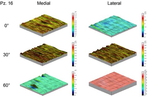 Roughness Digital Characterization and Influence on Wear of Retrieved ...