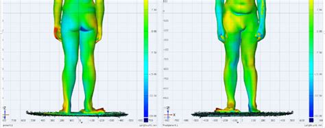 Image result for Global Compensation Program