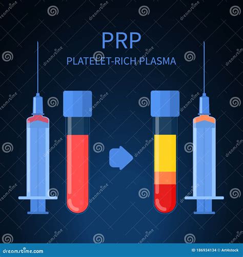 Platelet Rich Plasma Therapy Procedure Infographics Poster Stock Photo | CartoonDealer.com ...