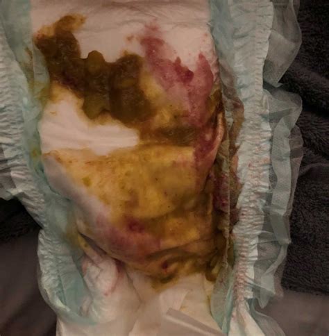 Baby Poo Guide- Types, Colours and What they Mean | Emma's Diary