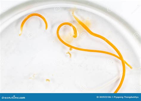 Thorny-headed Worms, or Spiny-headed Worms and Ascaris Under the Microscope for Education in ...