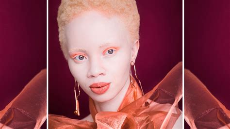 Thando Hopa: I’m a Black Woman Who Refuses to See My Albinism as a ...