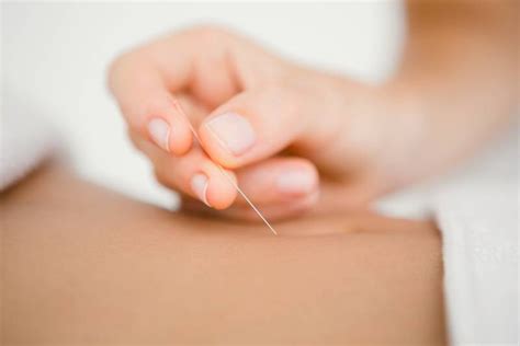 Acupuncture | Wholehealtherapy.com | Northeast Calgary