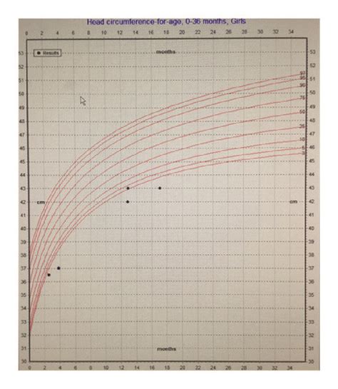 Normal Growth Patterns 的图像结果