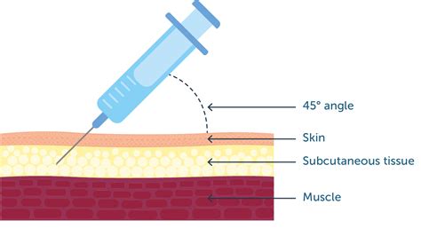 Subcutaneous Injection 的图像结果