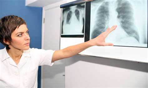 Pulmonary veno-occlusive disease in Sjogren's syndrome: a case report