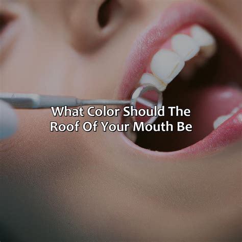 What Color Should The Roof Of Your Mouth Be - colorscombo.com