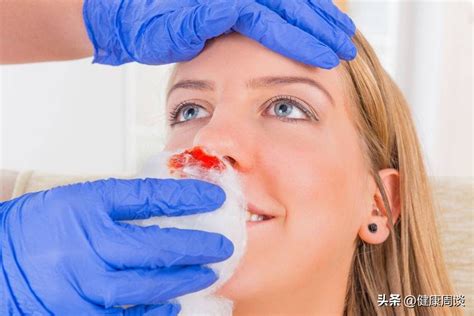 孩子流鼻血是什么原因引起的