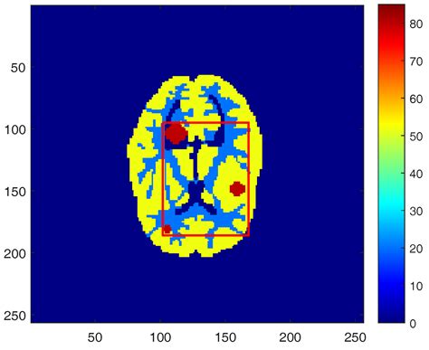 A Novel Kernel-Based Regularization Technique for PET Image Reconstruction