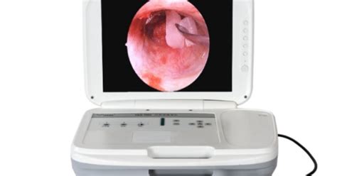 IKEDA Full HD Medical Portable Endoscope Camera- YKD-9003