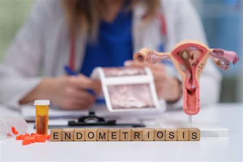 Remnant Cholesterol & Endometriosis: New Study Findings - memesita.com - Memesita