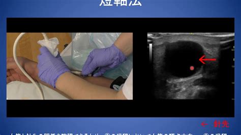 Image result for Retesting Positive HIV Test Algorithm