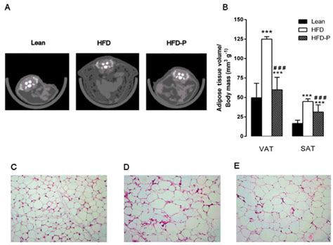 Pistachio Consumption Prevents and Improves Lipid Dysmetabolism by ...