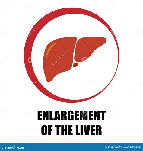 Enlargement of the Liver, Symptom Symbol in Red Circle Stock Vector - Illustration of care, sign ...
