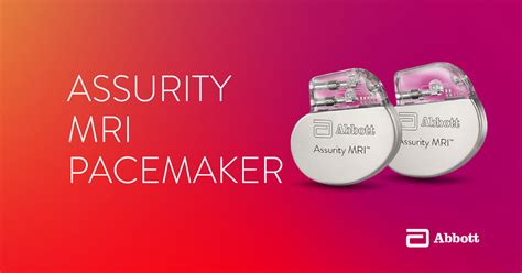 Image result for Merlin Pacemaker Monitor