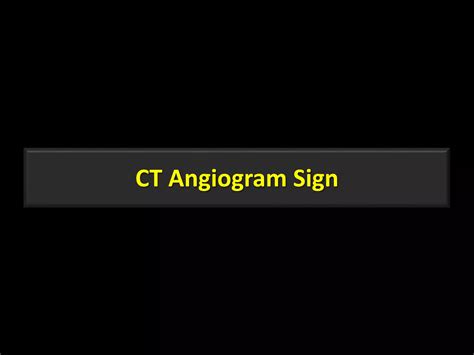 Deep sulcus sign fallen lung sign-ct angiogram sign-flat-waist sign | PPTX
