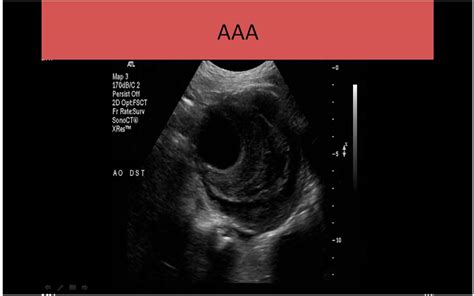 Ultrasound Registry Review Courses
