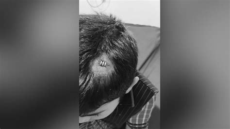 3-Year-Old Suffers Head Injury After Teacher Throws Tiffin Box At Him ...