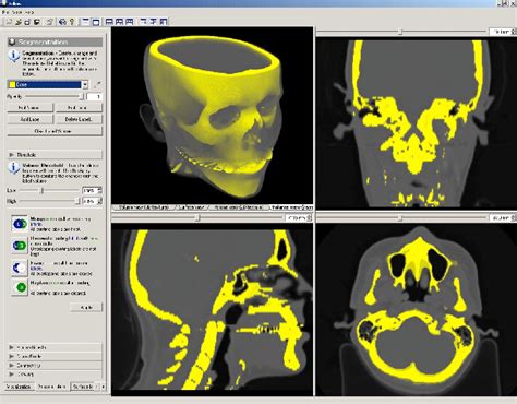 Segmentation Visualization Stack Overflow 的图像结果