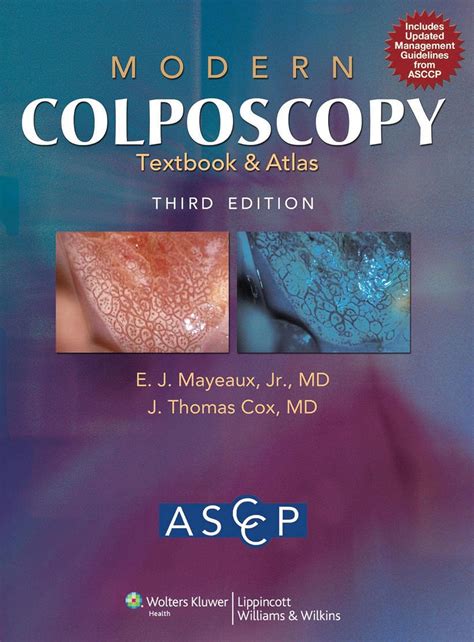 Buy Modern Colposcopy Textbook and Atlas Book Online at Low Prices in ...