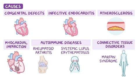 Mixed Heart Disease at Helen Byrne blog