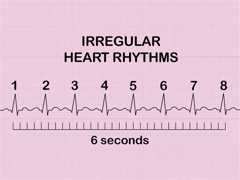 How to Calculate Heart Rate from ECG: 8 Steps (with Pictures)