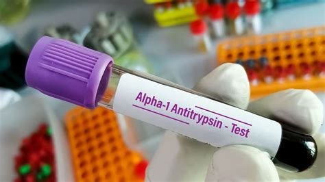 COPD-Management: Neues zum Einsatz von ICS, zu Komorbiditäten und zur ...