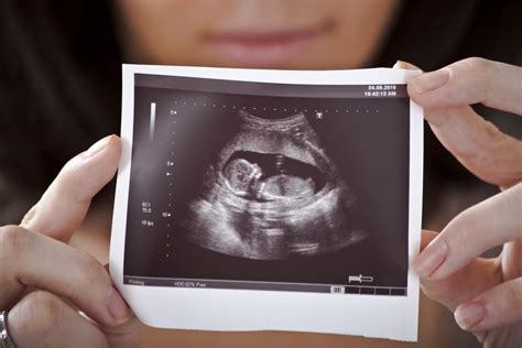 问医生这是18周B超图，怎么算胎儿大小，胎儿体重，是不是胎儿偏小，因月份较小，胎儿面部及胸腹腔细 - 百度宝宝知道