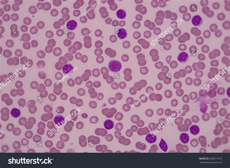White Blood Cells Microscope