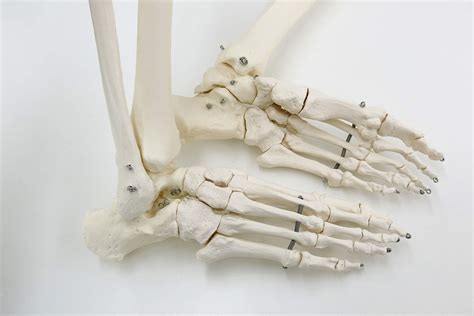 Buy 3B Scientific Human Anatomy Skeleton Model Fred - Flexible, On ...