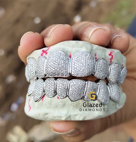 Moissanite Grillz | Iced-Out & Fully Custom Hip Hop Jewelry | Glazed ...