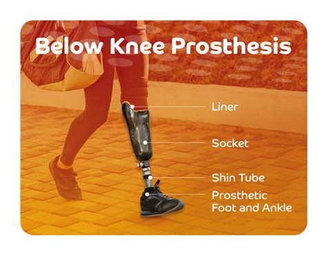 Prosthetic Leg Parts