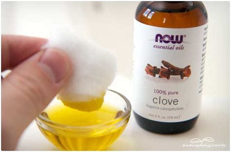 11 home and natural remedies for toothache pain