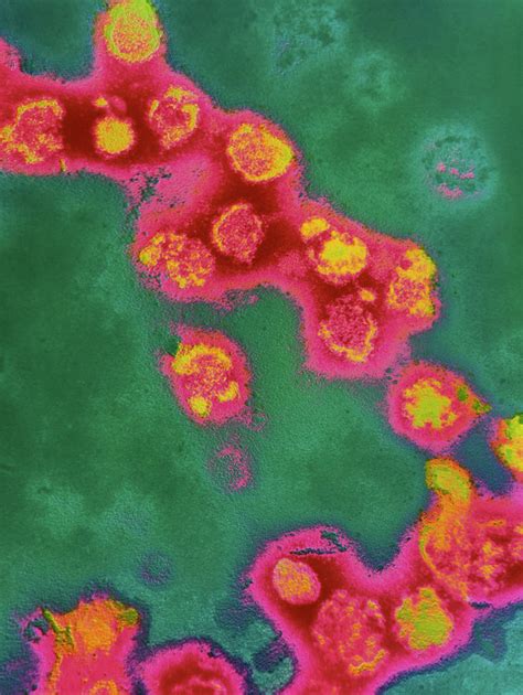 Bildergebnis für rubella virus